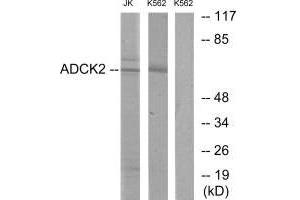Western blot analysis of extracts from Jurkat cells and K562 cells, using ADCK2 antibody. (ADCK2 anticorps)