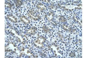 Rabbit Anti-WWP2 Antibody       Paraffin Embedded Tissue:  Human alveolar cell   Cellular Data:  Epithelial cells of renal tubule  Antibody Concentration:   4.