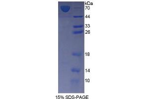 SDS-PAGE (SDS) image for Farnesyl Diphosphate Synthase (FDPS) (AA 1-353) protein (His tag,GST tag) (ABIN4990177)