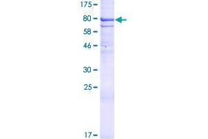 Image no. 1 for Dispatched Homolog 1 (DISP1) (AA 1-542) protein (GST tag) (ABIN1351635)