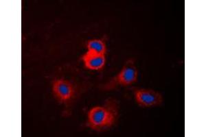 Immunofluorescent analysis of Cytochrome P450 17A1 staining in NIH3T3 cells.