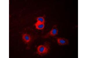 Immunofluorescent analysis of Cytochrome P450 17A1 staining in NIH3T3 cells. (CYP17A1 anticorps  (Center))