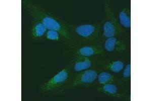 IF analysis of SETD3 using anti-SETD3 antibody (ABIN7600293). (SETD3 anticorps  (AA 173-468))