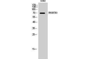 Western Blotting (WB) image for anti-rho-Related BTB Domain Containing 3 (RHOBTB3) (Internal Region) antibody (ABIN3177218) (RHOBTB3 anticorps  (Internal Region))