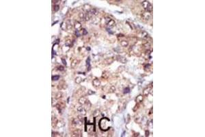 Immunohistochemistry (IHC) image for anti-V-Yes-1 Yamaguchi Sarcoma Viral Related Oncogene Homolog (LYN) antibody (ABIN3003450) (LYN anticorps)
