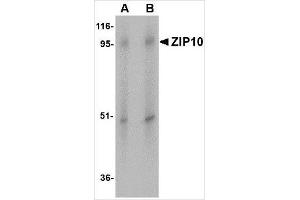 Western blot analysis of ZIP10 in human spleen tissue lysate with ZIP10 antibody at (A) 1 and (B) 2 μg/ml.