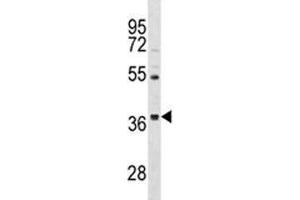 ORAI3 antibody western blot analysis in HepG2 lysate. (ORAI3 anticorps  (AA 1-30))