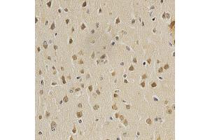 Immunohistochemistry of paraffin-embedded mouse brain using HDAC6 antibody (ABIN5997884) at dilution of 1/100 (40x lens). (HDAC6 anticorps)