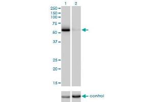 Western blot analysis of CDC25C over-expressed 293 cell line, cotransfected with CDC25C Validated Chimera RNAi (Lane 2) or non-transfected control (Lane 1).