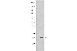 Western blot analysis of FAIM1 expression in 293T whole cell lysate ,The lane on the left is treated with the antigen-specific peptide. (FAIM anticorps  (Internal Region))