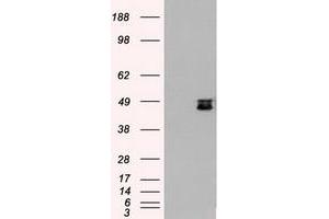 Image no. 4 for anti-Mitogen-Activated Protein Kinase Kinase 4 (MAP2K4) antibody (ABIN1499480)