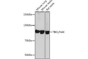 Western blot analysis of extracts of various cell lines, using TBK1/NAK Rabbit mAb (ABIN7270723) at 1:1000 dilution.