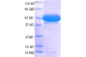 SDS-PAGE (SDS) image for Stanniocalcin 1 (STC1) (AA 39-247), (partial) protein (GST tag) (ABIN5712710) (Stanniocalcin 1 Protein (STC1) (AA 39-247, partial) (GST tag))