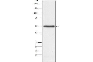 Western blot analysis of Nogo expression in HeLa cell lysate.