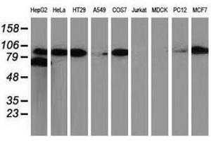 Image no. 6 for anti-Catenin (Cadherin-Associated Protein), beta 1, 88kDa (CTNNB1) antibody (ABIN1496889)