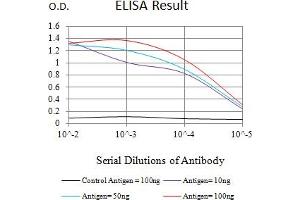 Black line: Control Antigen (100 ng),Purple line: Antigen (10 ng), Blue line: Antigen (50 ng), Red line:Antigen (100 ng)
