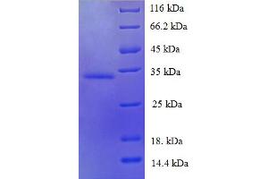 SDS-PAGE (SDS) image for Trefoil Factor 1 (TFF1) (AA 25-84) protein (GST tag) (ABIN5710476) (TFF1 Protein (AA 25-84) (GST tag))