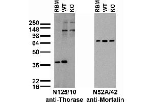 anti-ATPase Family, AAA Domain Containing 1 (ATAD1) (AA 1-361) antibody
