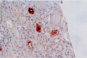 Immunohistochemistry staining of kidney allograft biopsy (paraffin-embedded sections) with anti-human HLA-G (MEM-G/2). (HLAG anticorps)