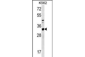 TIPRL Antibody (C-term) (ABIN1536814 and ABIN2849644) western blot analysis in K562 cell line lysates (35 μg/lane). (TIPRL anticorps  (C-Term))