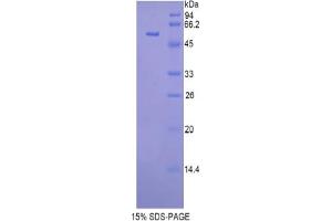 SDS-PAGE analysis of Mouse Glucosidase beta , Acid Protein. (GBA Protéine)