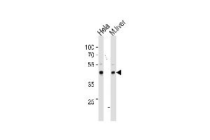 TBX6 Antibody (Center ) (ABIN655621 and ABIN2845101) western blot analysis in Hela cell line and mouse liver tissue lysates (35 μg/lane). (T-Box 6 anticorps  (AA 143-172))