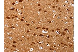 The image on the left is immunohistochemistry of paraffin-embedded Human brain tissue using ABIN7130740(PSMD3 Antibody) at dilution 1/25, on the right is treated with fusion protein. (PSMD3 anticorps)