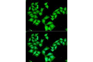 Immunofluorescence analysis of HeLa cells using AAAS antibody (ABIN5973827). (Adracalin anticorps)