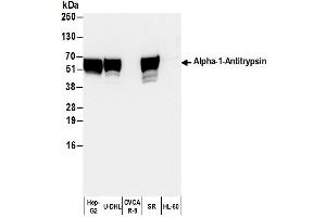 Western Blotting (WB) image for anti-serpin Peptidase Inhibitor, Clade A (Alpha-1 Antiproteinase, Antitrypsin), Member 1 (SERPINA1) antibody (HRP) (ABIN7449499)
