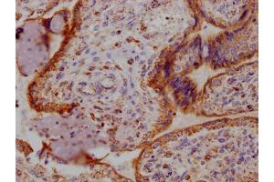 IHC image of ABIN7127339 diluted at 1:100 and staining in paraffin-embedded human placenta tissue performed on a Leica BondTM system. (Recombinant Angiopoietin 2 anticorps)