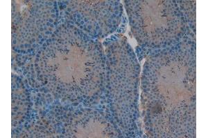 IHC-P analysis of Mouse Testis Tissue, with DAB staining. (RELB anticorps  (AA 176-436))