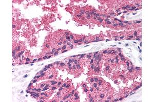 Anti-LDB1 antibody IHC of human prostate.