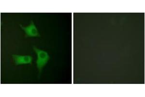 Immunofluorescence analysis of HeLa cells, using p15 INK Antibody.