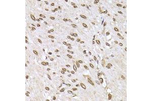 Immunohistochemistry of paraffin-embedded human colon carcinoma using LMNB2 Antibody.
