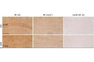 anti-Phorbol-12-Myristate-13-Acetate-Induced Protein 1 (PMAIP1) antibody