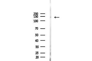 Western blot analysis of lysates from Mouse lung, using MLCK Antibody at 1/1000 dilution.