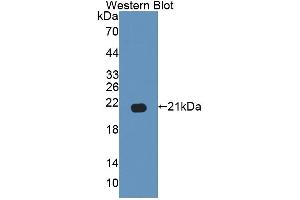 Detection of Recombinant GAS6, Human using Polyclonal Antibody to Growth Arrest Specific Protein 6 (GAS6)