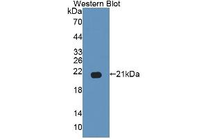 Detection of Recombinant GAS6, Human using Polyclonal Antibody to Growth Arrest Specific Protein 6 (GAS6) (GAS6 anticorps  (AA 503-664))