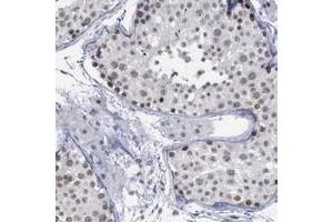 Immunohistochemical staining of human testis with BRD1 polyclonal antibody  shows moderate nuclear positivity in seminiferus ducts.