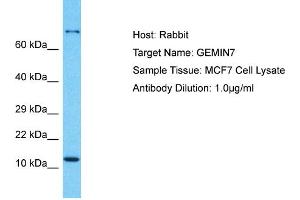 Host: Rabbit Target Name: GEMIN7 Sample Type: MCF7 Whole Cell lysates Antibody Dilution: 1. (GEMIN7 anticorps  (N-Term))
