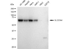 Western blotting analysis using SLC27A4 antibody (ABIN7800393).
