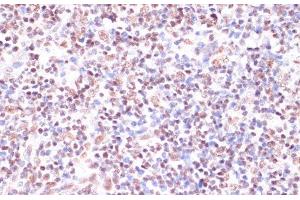 Immunohistochemistry of paraffin-embedded Human lymph node using CREB1 Polyclonal Antibody at dilution of 1:100 (40x lens). (CREB1 anticorps)