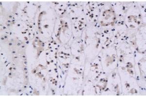 Immunohistochemistry (IHC) image for anti-Interferon gamma (IFNG) (AA 81-166) antibody (ABIN669141)
