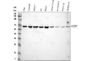Western blot analysis of STIP1 using anti-STIP1 antibody (ABIN3044551).