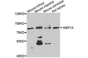 Western blot analysis of extract of various cells, using MEP1A antibody. (MEP1A anticorps)