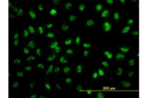 Immunofluorescence of monoclonal antibody to SNAI2 on HeLa cell. (SLUG anticorps  (AA 97-169))
