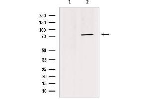 Western blot analysis of extracts from HepG2, using TRI18 Antibody. (MID1 anticorps  (N-Term))