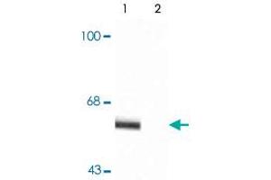 Western blot of rat cortex lysate showing specific immunolabeling of the ~60k - ~62k Syt1 phosphorylated at Thr202 (Control). (SYT1 anticorps  (pThr202))