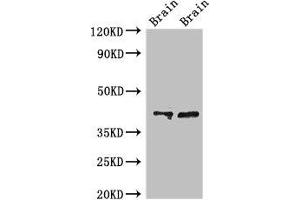 Western Blot Positive WB detected in: Rat brain tissue, Mouse brain tissue All lanes: CAMK1 antibody at 3 μg/mL Secondary Goat polyclonal to rabbit IgG at 1/50000 dilution Predicted band size: 42 kDa Observed band size: 42 kDa