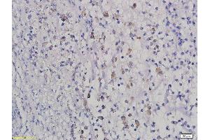 Formalin-fixed and paraffin embedded rat intestine labeled with Anti HOXB8 Polyclonal Antibody, Unconjugated  followed by conjugation to the secondary antibody and DAB staining (HOXB8 anticorps  (AA 11-110))